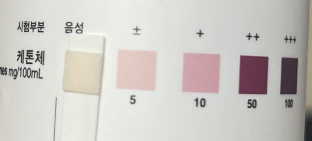 [체지방 대사 실험기] 24시간 단식 중 케톤 수치는 어떻게 변할까? (하루 종합 리포트)